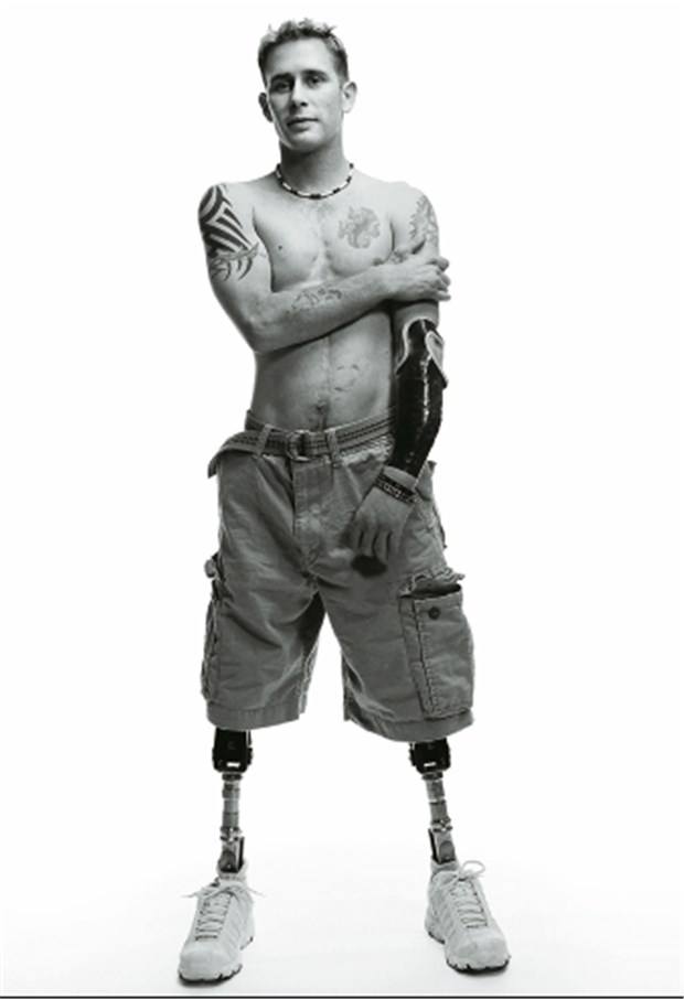 Der Krieg und die Medizin Mit Hilfe von Ärzten und moderner Medizintechnik gerettet: Der heute 28-jährige US-Soldat Bryan Anderson verlor 2005 durch eine Bombe in Bagdad seine Beine, einen Unterarm, eine Hand und drei Fingerspitzen.