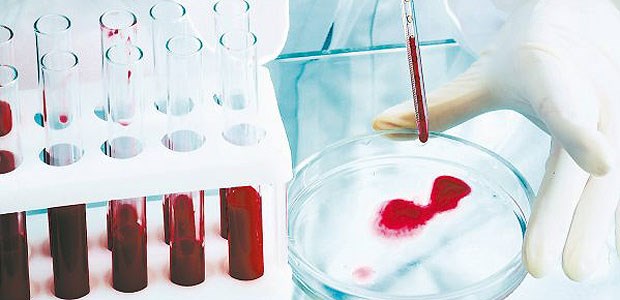 Eine Chance für Patienten Mit Hochdruck wird in den Laboren beispielsweise an neuen diagnostischen Verfahren zur personalisierten Medizin geforscht.