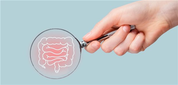 Mit Koloskopien und Stuhltests dem Darmkrebs auf der Spur: Der G-BA fasste dazu am Donnerstag einen wegweisenden Beschluss.
