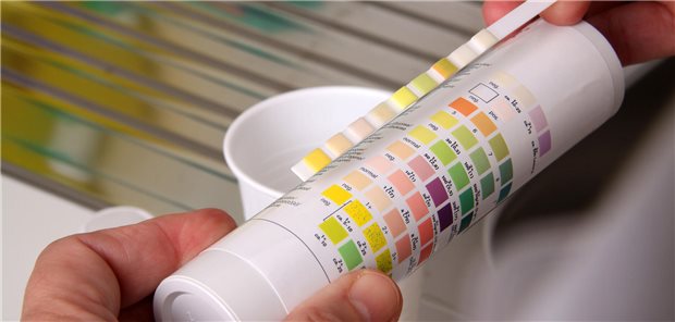 Mit Urinteststreifen lassen sich ja Veränderung der Urinzusammensetzung außerhalb des Labors nachweisen. Ist zu jedoch viel Blut im Urin, funktioniert der Streifentest nicht mehr.