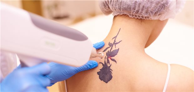 Mit dem neuen Musterfortbildungscurriculum können MFA künftig Aufgaben aus dem Bereich Lasereinrichtungen und intensiven Lichtquellen übernehmen.