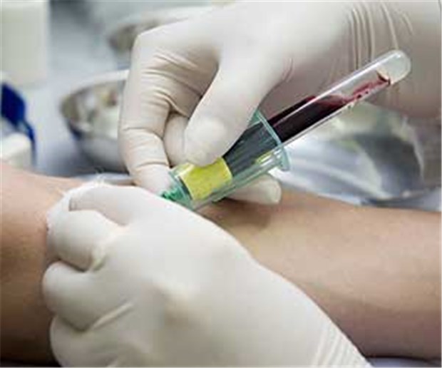 Forscher: Lungenkrebs lässt sich im Blut diagnostizieren Mit einem Bluttest könnte womöglich bald Lungenkrebs diagnostiziert werden.