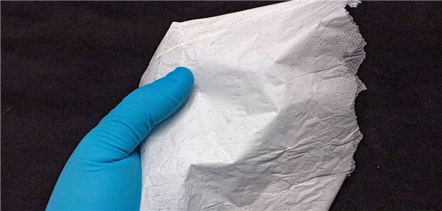 Maßgeschneiderte Wundauflagen aus humanem Tropoelastin Mit einem elektrogesponnenen Vlies aus biotechnologisch hergestelltem Tropoelastin möchten Forscher die Wundversorgung vereinfachen.