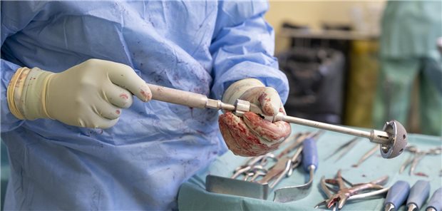 Mit einer künstlichen Hüftpfanne wird eben auch Geld verdient.