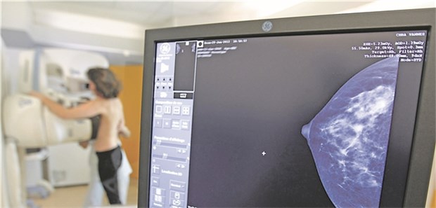 Weniger Kontrollen, mehr Biopsien Mit regelmäßiger Mammografie werden mehr Tumoren im frühen Stadium entdeckt.