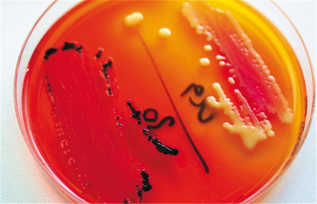 Neue Wege gegen problematische Keime Mit solchen Bakterienkulturen lässt sich die Wirksamkeit von Antibiotika prüfen, und es können Resistenzen erfasst werden.