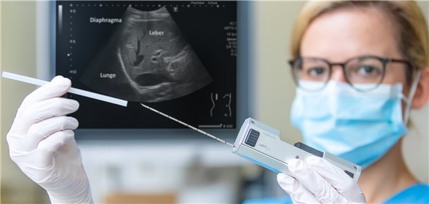 Wer nach neuer Leber biopsiert, kann die Nieren schützen Mit solchen Nadeln werden Biopsien nach Lebertransplantationen durchgeführt. Das ermöglicht Einblicke in den Zustand des Transplantats, mit deren Hilfe die Unterdrückung des Immunsystems individuell angepasst werden kann.