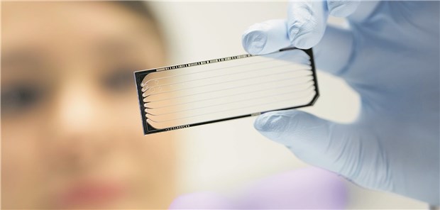 Seltene Mutation macht Pankreas-Ca angreifbar Mithilfe der Hochdurchsatzsequenzierung entdeckten Forscher eine Besonderheit im Genom von Zellen eines Pankreaskarzinoms.