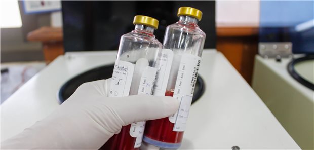 Mithilfe einer Blutkultur wird versucht, die Erreger bei Pneumonie zu finden und zu identifizieren.
