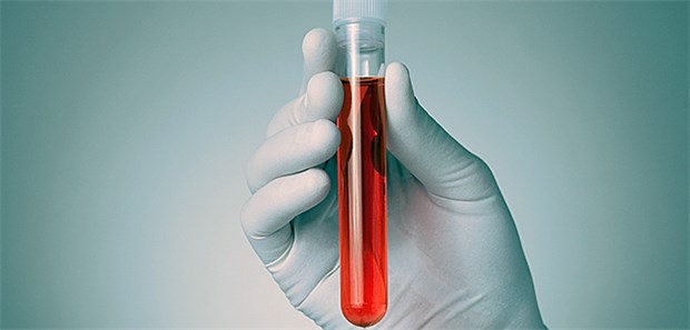 DNA-Screening ersetzt nicht den Ultraschall Mithilfe von Tests wird das Blutplasma der Schwangeren untersucht, in dem sich nicht nur Teilstücke deren eigenen Erbmaterials befinden, sondern bis zu zehn Prozent zellfreie DNA der Plazenta.