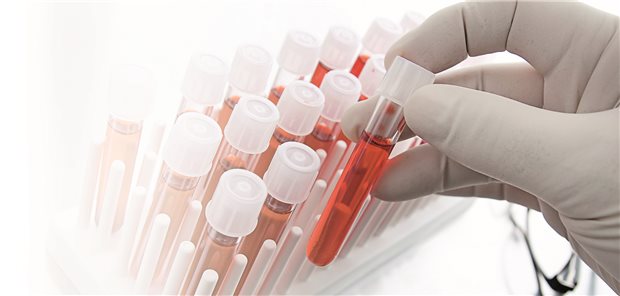 Mittels Blutuntersuchungen lassen sich verschiedene Krankheiten diagnostizieren. Auch für Long-COVID-Patientinnen und Patienten könnte dies einer Studie zufolge zukünftig möglich sein.