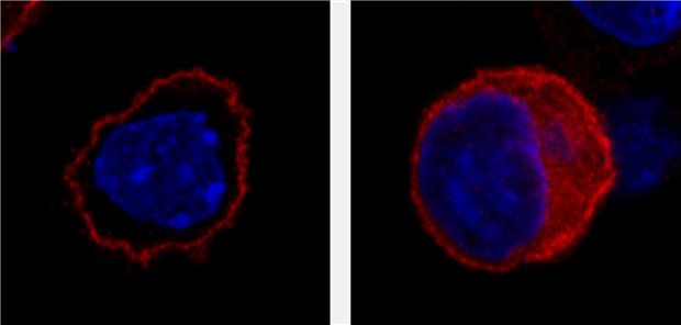 Mittels Immunfluoreszenz wird unter dem Mikroskop sichtbar, dass das intakte SLC4A10-Protein (rot, links) an der Zelloberfläche lokalisiert, während das mutierte Protein überwiegend im Zellinneren bleibt. Bestimmte geladene Teilchen können so nicht mehr ausreichend über die Zellwand transportiert werden.