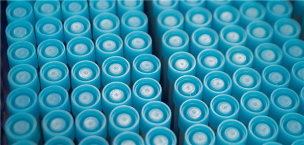 Mittlerweile fast schon regelmäßig eine Leistung aus einem MVZ: Labor.