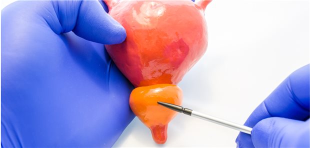 Modell einer Prostata: Keine Angst vor einer zu späten Therapie, raten Urologen.