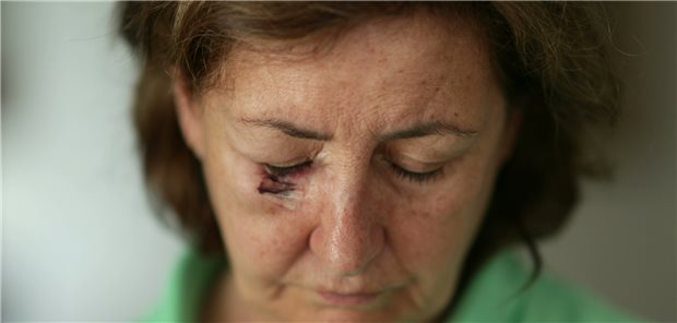 Frau mit OP-Wunde unter dem Auge