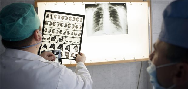 Tuberkulose: „Das neue Jahrzehnt wird entscheidend“ Moldauische Ärzte besprechen den Fall eines Tuberkulose-Patienten. In Osteuropa sind multiresistente TB-Erreger weit verbreitet.