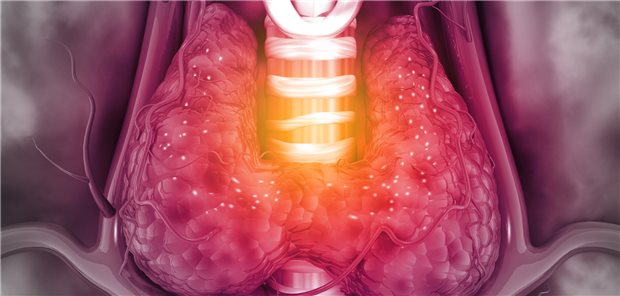 Momentan im Fokus: Der Ausschuss für Risikobewertung im Bereich der Pharmakovigilanz (PRAC) bei der Europäischen Arzneimittelagentur hat eine Überprüfung der GLP-1-Rezeptoragonisten in Hinblick auf ein womöglich erhöhtes Risiko seltener Schilddrüsenkarzinome angestoßen. 
