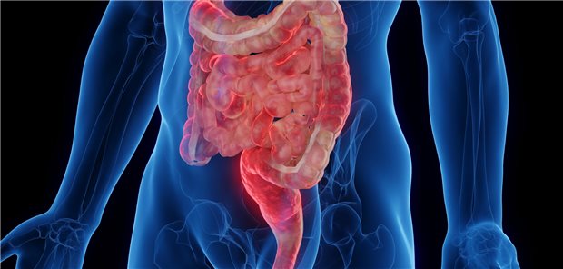 Morbus Crohn im Fokus: Obwohl Biologika seit über 20 Jahren bei Morbus Crohn eingesetzt werden, gibt es kaum vergleichende Studien gegenüber etablierten Wirkstoffen.&#xA;