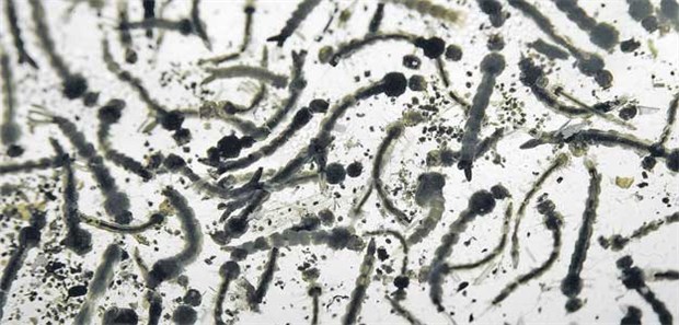 Sexuelle Übertragung möglich Mückenlarven unter dem Mikroskop. Überträger des Zika-Virus ist unter anderem die Tigermücke.