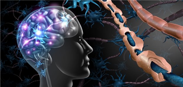 Multiple Sklerose: Anhand des Neurofilament-Light-Chain-Wertes kann das Risiko für eine Krankheitsaktivität als auch für eine Therapieantwort ermittelt werden. Das ist das Ergebnis einer Studie aus Basel.