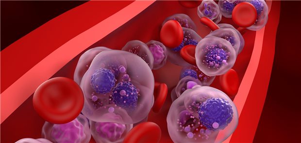 Multiples Myelom: Erfolg mit bispezifischem Antikörper Multiples Myelom: Elranatamab führte bei stark vorbehandeltem rrMM zu einem medianen progressionsfreien Überleben (mPFS) von 17,2 Monaten. Bisher erreichten diese Patientinnen und Patienten typischerweise ein mPFS von vier bis fünf Monaten.