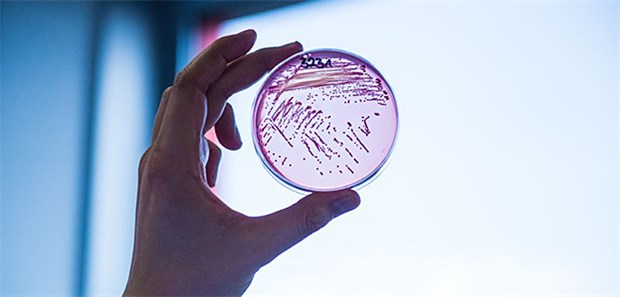 Multiresistenter E. coli-Stamm auf dem Vormarsch Multiresistente E. coli-Bakterien