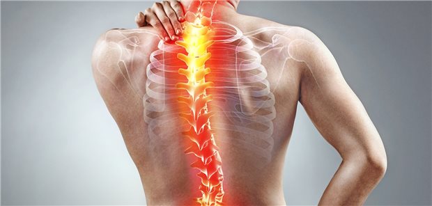 Muskelrelaxanzien bei Rückenschmerz? Dazu herrscht in internationalen Leitlinien keine Einigkeit.