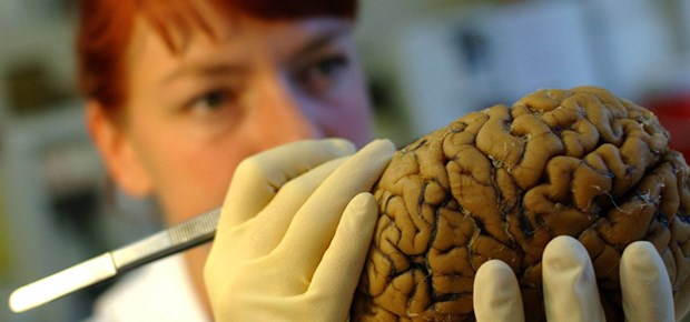 Die theoretische Medizin verarmt Muss auch jemand machen: Präparation in der Pathologie.