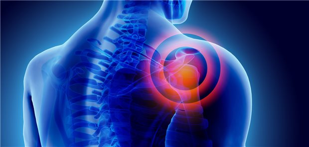 Muss das Schultergelenk ersetzt werden, stehen Prothesen mit und ohne Schaft zur Verfügung. Doch wie sieht es mit der Lockerungsrate der beiden Verfahren aus?