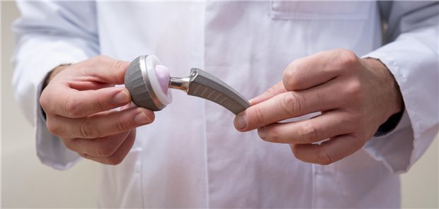 Ein Arzt hat einen Gelenkersatz in der Hand.