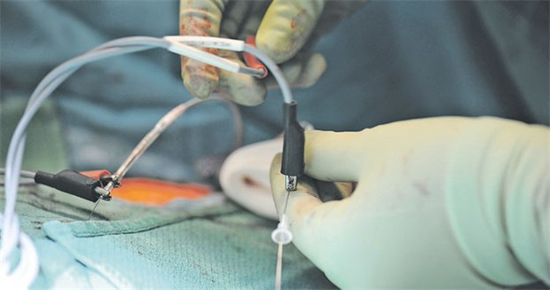 BGH bestätigt strenges Haftungsrecht Muss der Herzschrittmacher ausgetauscht werden? Die Frage beschäftigt oft Gerichte.