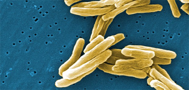 Neue Kombi soll Durchbruch bringen Mycobacterium tuberculosis: Wird PaMZ die Therapie bei MDR-Tb entscheidend verbessern?