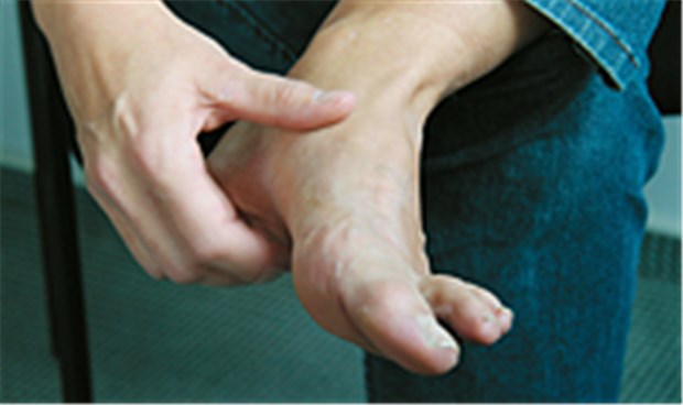 Fußschmerz bei Diabetikern kann viele Ursachen haben Myofaszielle Schmerzen bei diabetischer Polyneuropathie kann man durch Abtasten der Fußsohle erkennen.