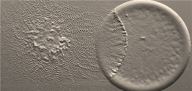 Myxococcus xanthus ist Mikrobe des Jahres 2020 Myxococcus xanthus jagt im Schwarm eine Escherichia coli-Kolonie.