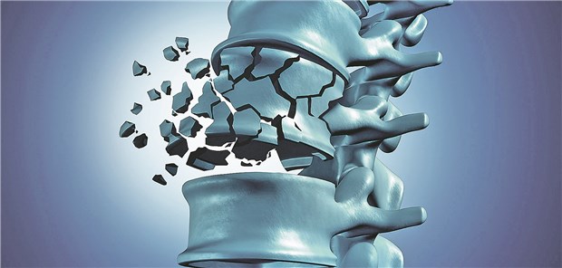 NOAKs sind für Vorhofflimmernpatienten mit hohem Frakturrisiko offenbar die bessere Wahl. 