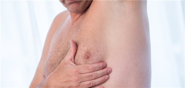 Na, ist da ein Knoten? Ist er unfruchtbar, ist sein Risiko für Brustkrebs größer (Symbolbild mit Fotomodell).