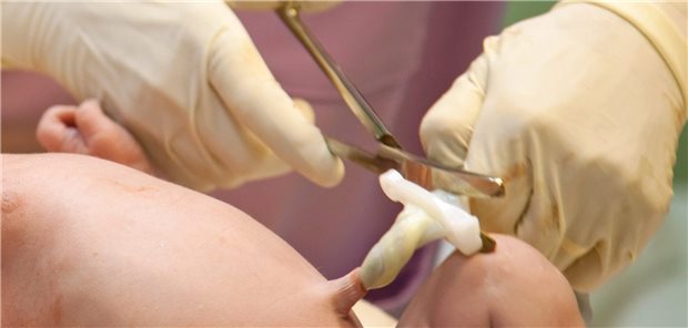 Nabelschnurblut ist eine gute Quelle für Stammzellen.