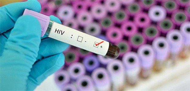 HIV-Infektionen gehen weltweit zurück Nach Schätzungen der Vereinten Nationen waren 2018 rund 37,9 Millionen Menschen mit dem HI-Virus infiziert.