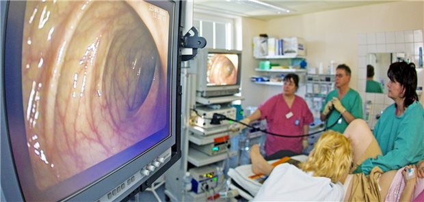 Nach befundfreier Vorsorge-Koloskopie war die Darmkrebsrate bei Personen, deren Erstuntersuchung bereits zehn Jahre zurücklag, sehr niedrig.