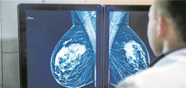 Krebsscreening: EU-Kommission will mehr Tempo sehen Nach dem Willen der EU-Kommission sollen europaweit künftig alle Frauen in der Altersspanne von 45 bis 74 Jahre im Rahmen eines nationalen Krebsscreenings ein Angebot zur Mammographie bekommen.