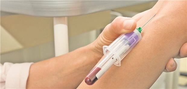 Nach den Ergebnisse einer Studie könnte es zukünftig möglich sein, Alzheimer durch eine Blutuntersuchung frühzeitig zu diagnostizieren.