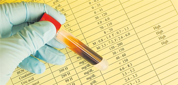 Das 'Wie' ist entscheidend Nach den kürzlich aktualisierten ESC-Leitlinien sollte bei erhöhtem LDL-C zunächst eine Therapie mit einem Statin begonnen werden.