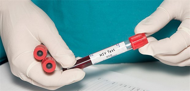 Ziel ist die Unterdrückung der Viruslast Nach der Diagnose HIV ist die derzeit wichtigste therapeutische Frage: Wie lässt sich eine Remission erreichen?