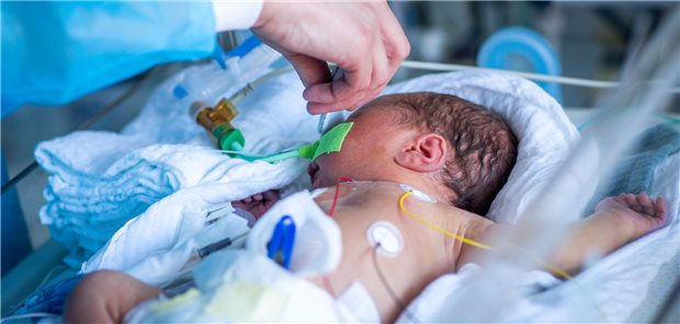Frühgeborenes auf der Intensivstation