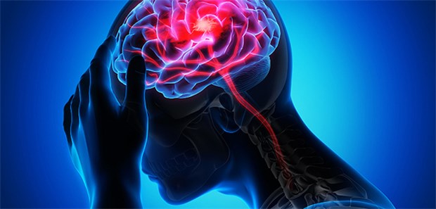 Nach einem Schlaganfall bräuchten viele Patienten spezielle Trainingsprogramme, betont Professor Diener.