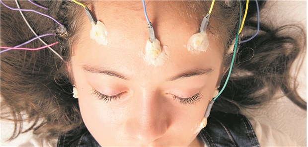 Nach einem ersten unprovozierten Anfall behandeln oder nicht behandeln? Hierbei sollte auch das Lebensalter bedacht werden.