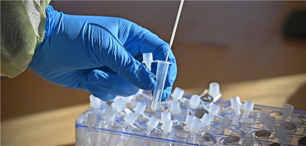 Nach einem positiven Corona-Testergebnis und durchgemachter COVID-19 können Langzeitfolgen bleiben. Ein Forscherteam analysierte nun, ob auch Diabetes mellitus dazugehört.