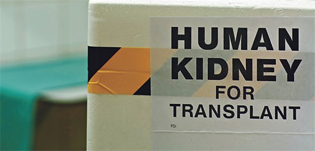 Gehäuft nach Organtransplantation Nach einer Organtransplantation expandieren Nicht-Melanom-Karzinome häufig subklinisch.