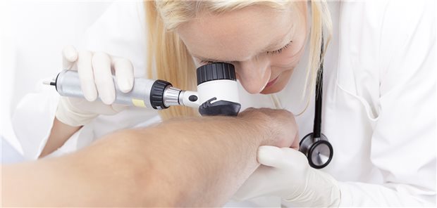 Nach voll reseziertem Melanom: Rezidiv oder nicht? (Symbolbild mit Fotomodell)