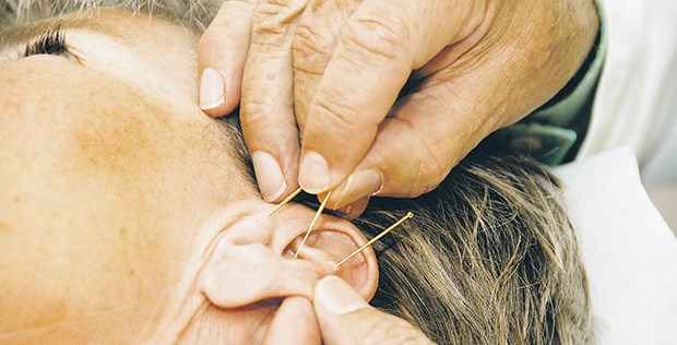 Nadeln im Ohr: Zu den Leistungen der TGP gehört auch die Akupunktur, etwa zur Raucherentwöhnung.